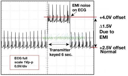 1.5 英尺以外的發(fā)射器(f = 470 MHz, P= 0.5W)開啟和關(guān)閉時(shí)ECG 診斷設(shè)備的心臟檢查結(jié)果