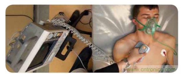 帶電極的醫(yī)院用除顫器。注意，患者身上有外部心電圖或心臟監(jiān)護(hù)儀，從胸部的白色圓片(電極)和導(dǎo)聯(lián)(線)可看出來。