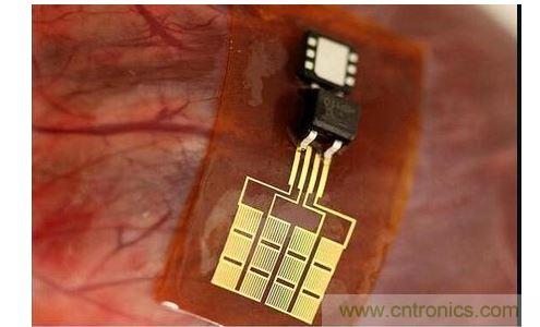 可將人體變成電腦的電子皮膚！