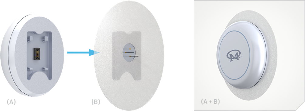 如何使用動態(tài)血糖監(jiān)測設備(CGM)管理糖尿病