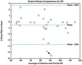 動(dòng)態(tài)離散周期變換技術(shù)突破：無(wú)ECG參考的生理信號(hào)精準(zhǔn)解析